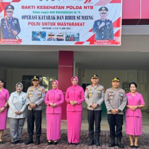 Sambut Hari Bhayangkara ke-79, Polda NTB Gelar Operasi Katarak dan Bibir Sumbing Gratis di RS Bhayangkara