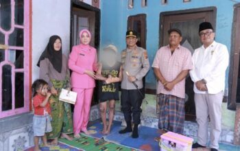 Kapolda NTB Jenguk Korban Tersulut Api di Ponpes di Lombok Tengah, Janji Kawal Restitusi dan Tuntaskan Kasus